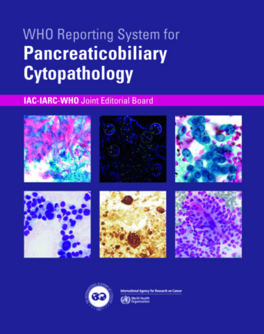 WHO Reporting System for Pancreaticobiliary Cytopathology